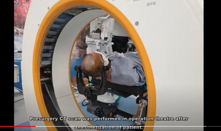 Neurosurgery - Intraoperative CT guided Colloid Cyst Excision