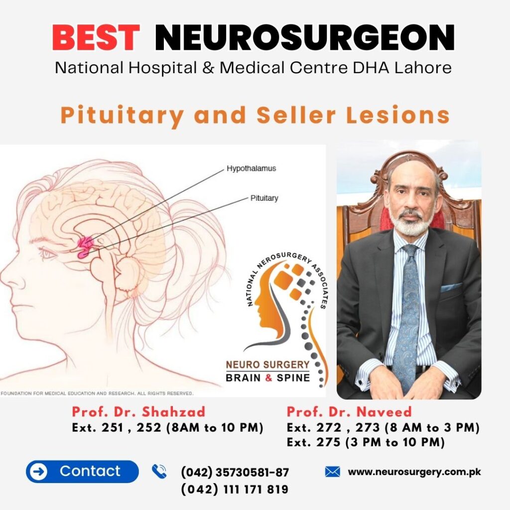 Pituitary and Sellar Lesions