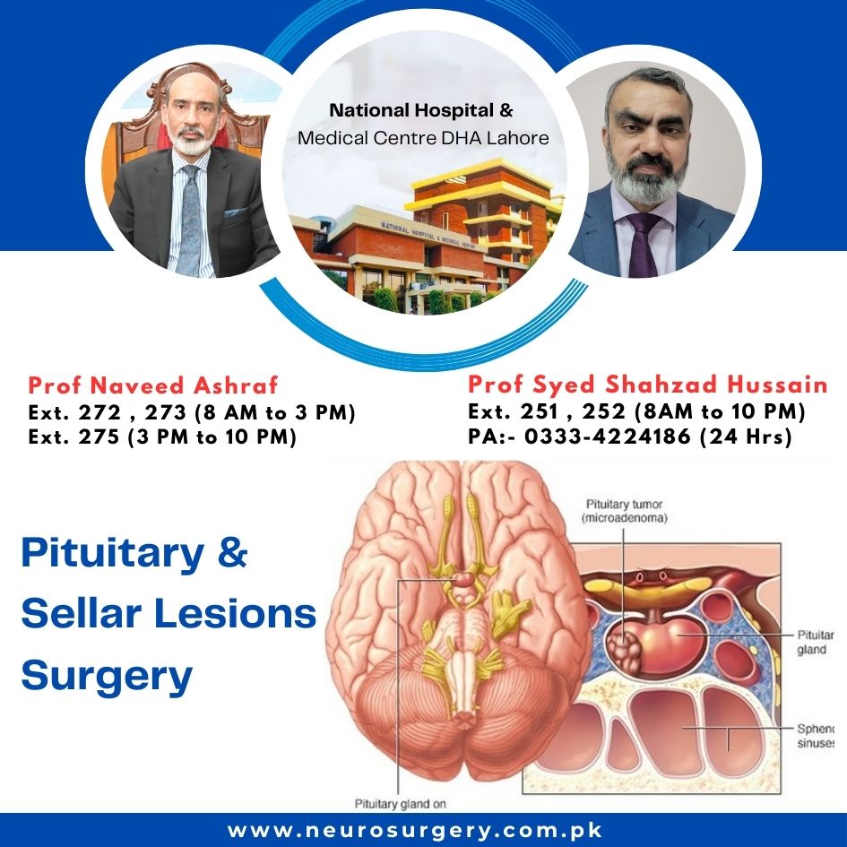 Pituitary and Sellar Lesions