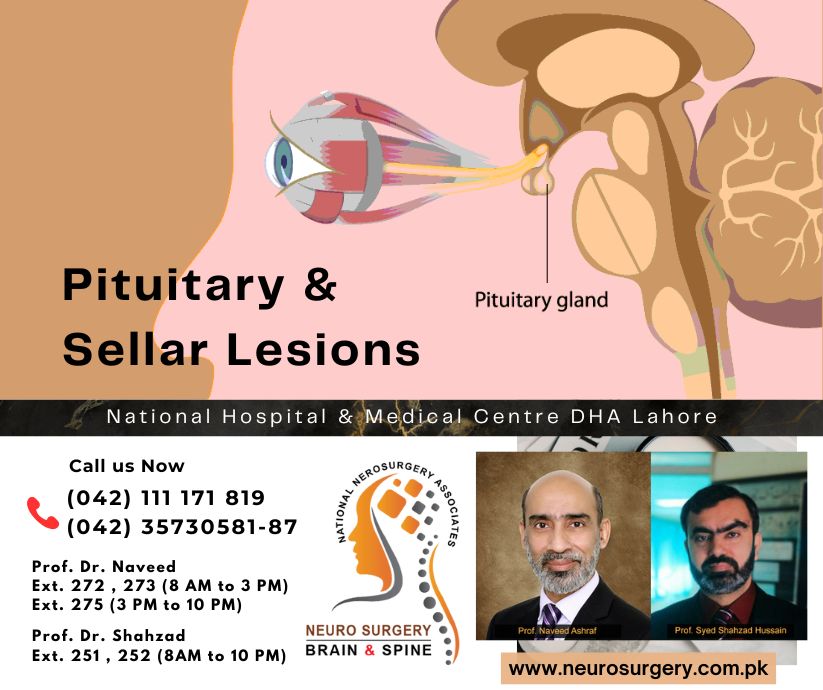 Pituitary and Sellar Lesions