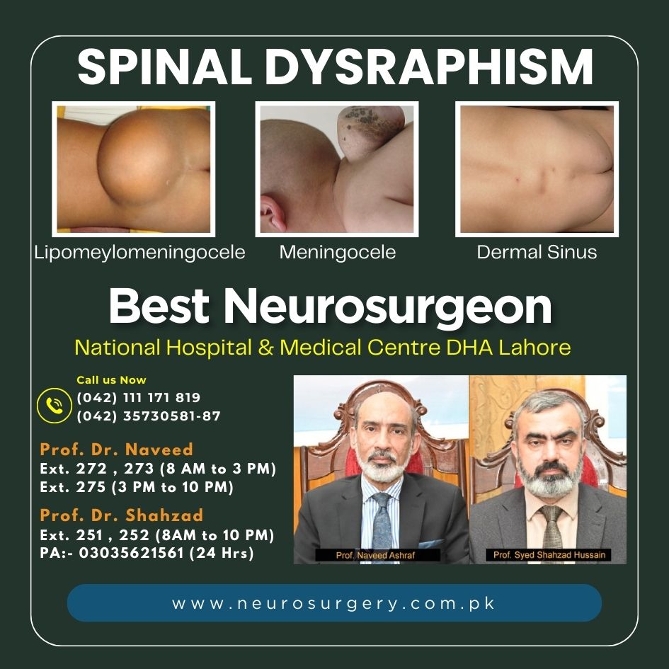Spinal Dysraphism