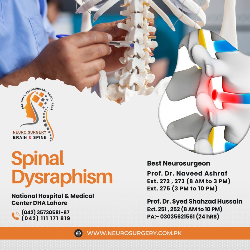 Spinal Dysraphism