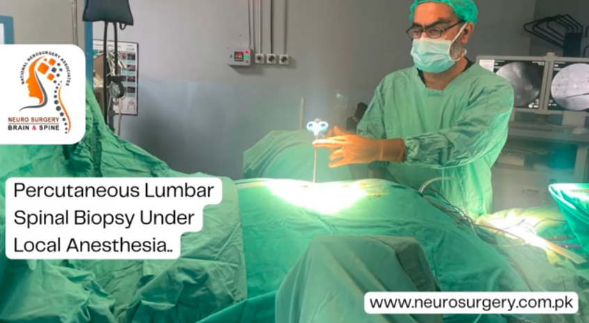 Percutaneous Lumbar Spinal Biopsy Under Local Anesthesia