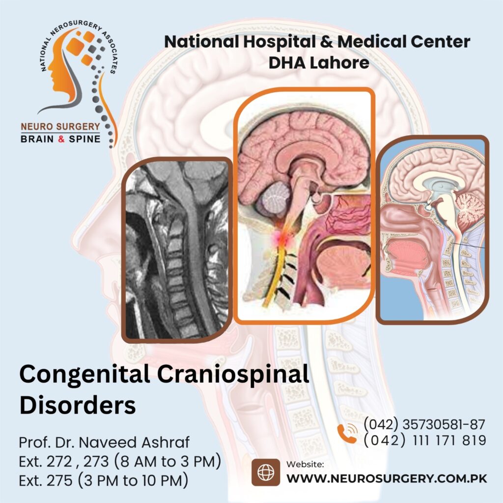 congenital craniospinal disorders - best neuro surgeon in pakistan