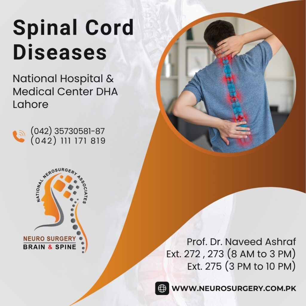 spinal cord diseases - best neurosurgery lahore pakistan
