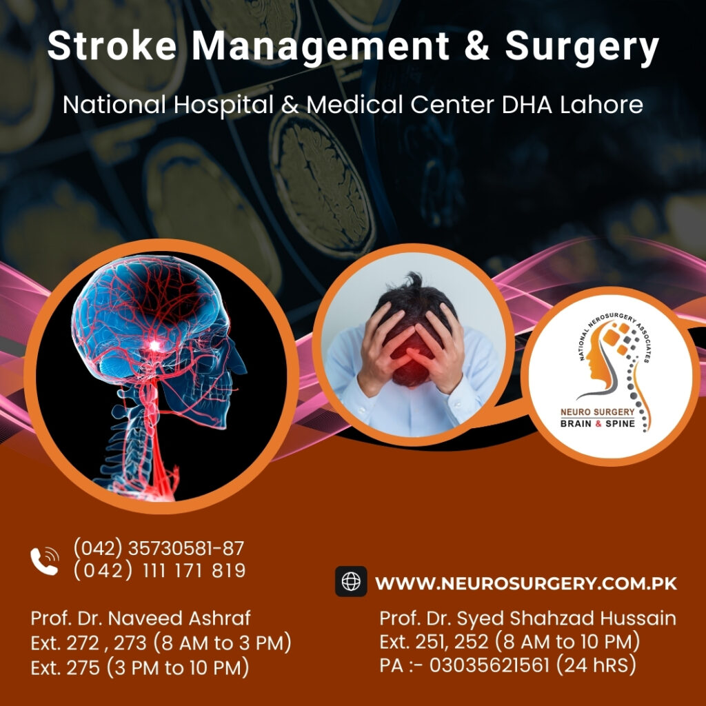 stroke management and surgery - neurosurgery - best neuro surgeon