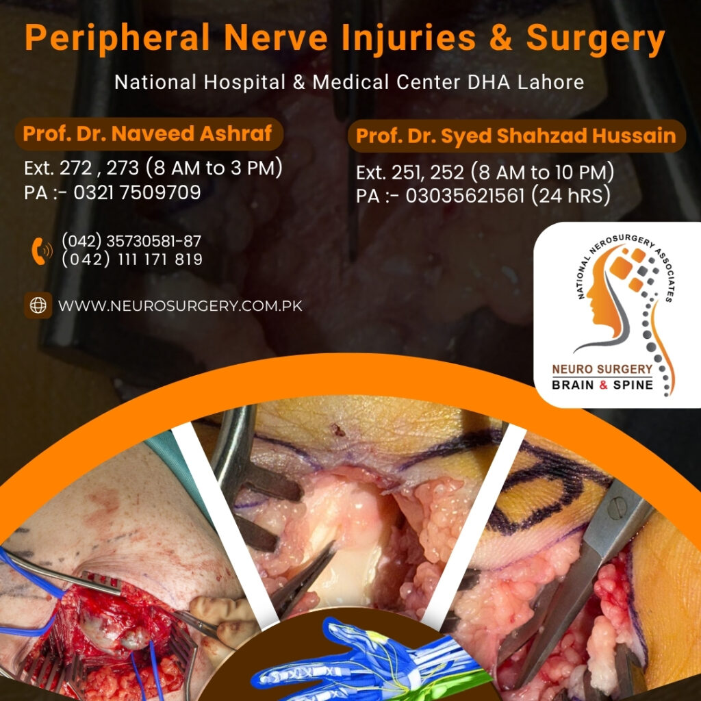 best Peripheral Nerve Injuries and Surgery in Lahore Pakistan